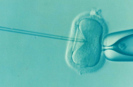 <p>Imagen de la extracción de un ovulo para su congelación.</p>