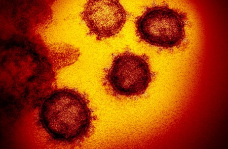 <p>Imagen microscópica del coronavirus aislado de un paciente de EE.UU.</p>