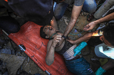 <p>Un niño herido por los bombardeos es atendido por sanitarios en Gaza, el pasado 12 de noviembre. <strong>/ Mohammed Zannoun </strong></p>