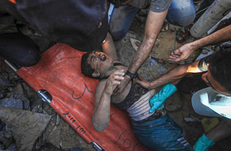 <p>Un niño herido por los bombardeos es atendido por sanitarios en Gaza, el pasado 12 de noviembre. / <strong>Mohammed Zannoun</strong></p>