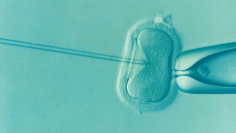 <p>Imagen de la extracción de un ovulo para su congelación.</p>