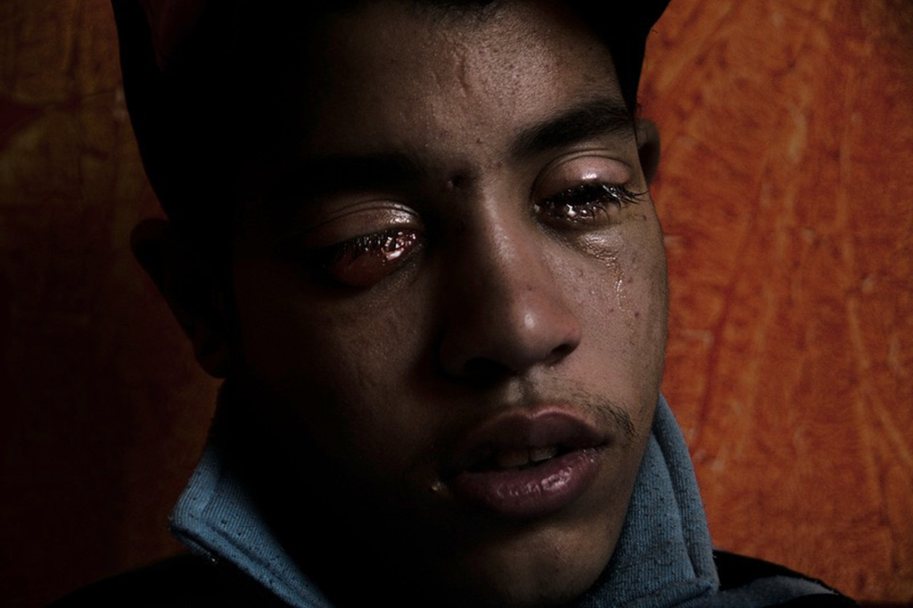 Reda, de 19 años, recibió un tiro en el ojo el 19 de noviembre de 2011. Se encontraba en la plaza Moustafa Mahmoud apoyando a los manifestantes. 